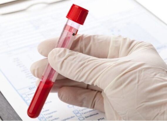 Laboratorijas diagnostikas metodes ļauj noteikt patoloģisko mikrofloru vai vīrusu
